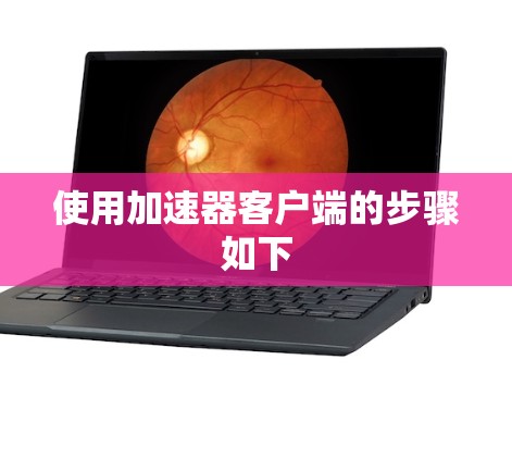 使用加速器客户端的步骤如下